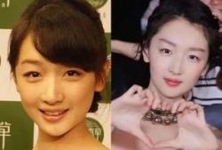 林志玲美白针爆料视频,揭秘明星美容秘籍背后的真相